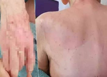 Huzurevindeki vefatta beklenen rapor geldi: Dermatolojik hastalık tespit edilmedi